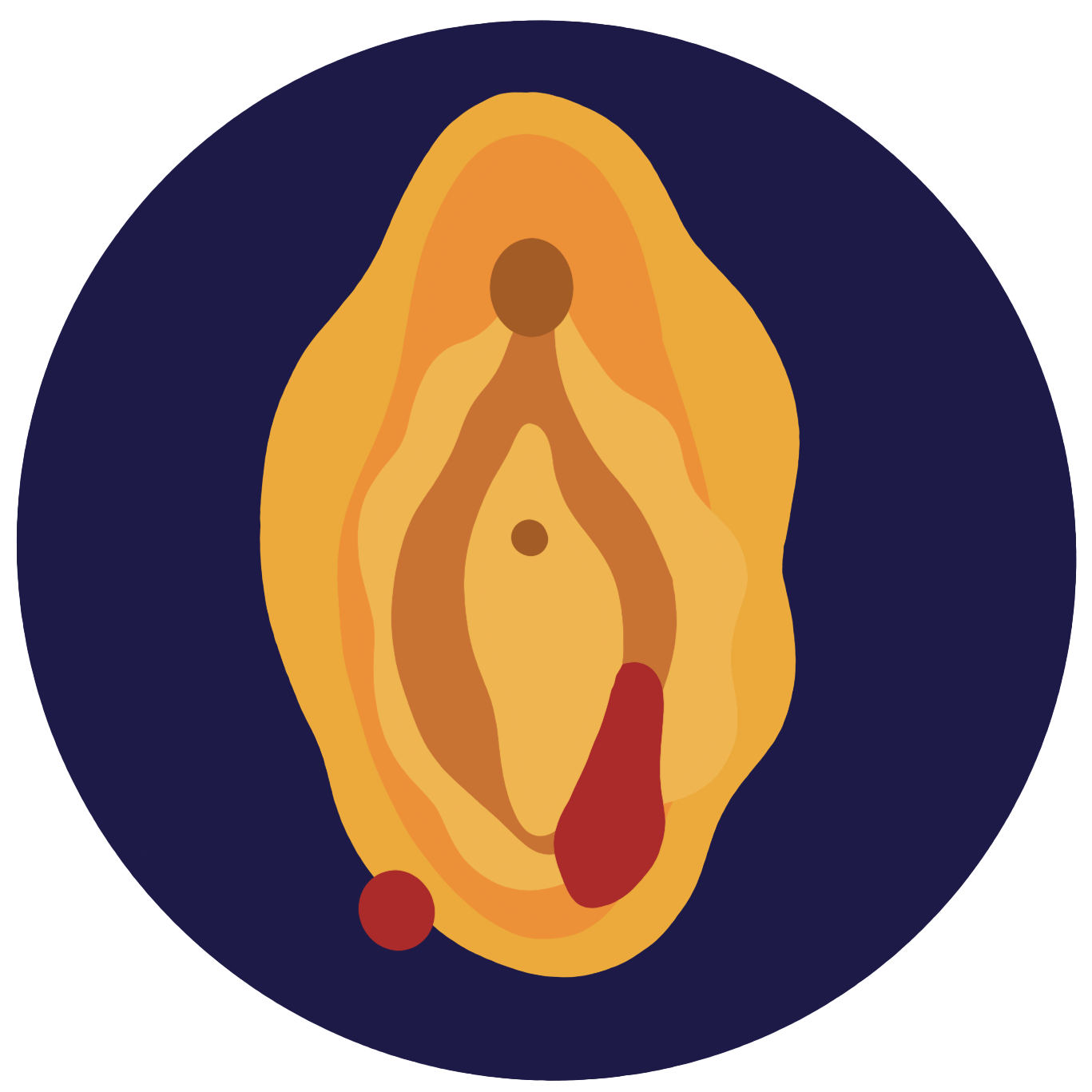 Bartholin Cysts
